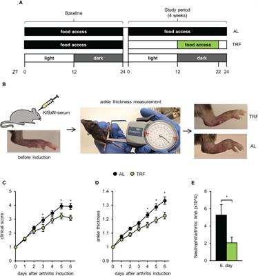 Time restricted feeding modifies leukocyte responsiveness and improves inflammation outcome